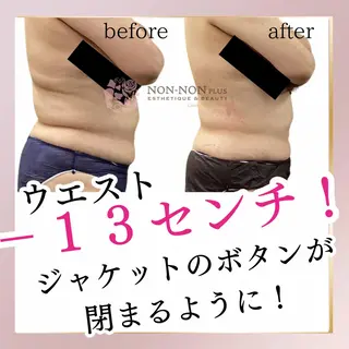NON-NONプラス 大人の本気痩身のエステ・リラクイメージ