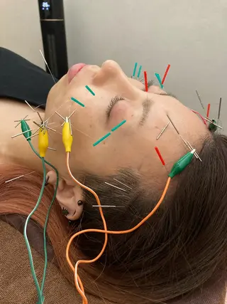 美容鍼灸整体サロンBeauJu所属・小顔矯/美容鍼/鍼灸 BeauJuのその他イメージ