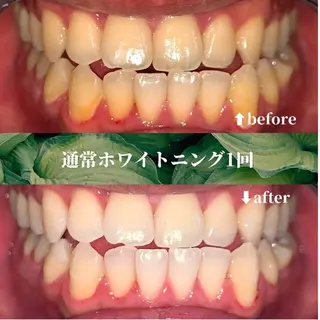 futaba ホワイトニング/天神のエステ・リラクイメージ