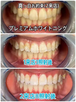 Platinum Beauty 四条烏丸店所属・吉田亮利 ホワイトニング専門店のその他イメージ