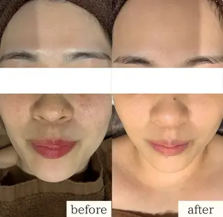 DahliaBeauty ダリアビューティー所属・DahliaBeau tyフェイシャル中村のエステ・リラクイメージ