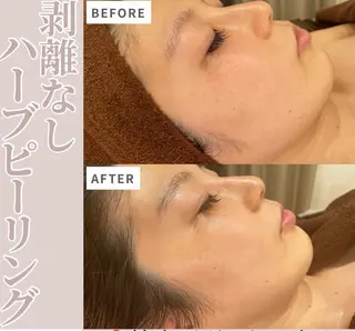 🦋肌改善 laule'a🦋のエステ・リラクイメージ