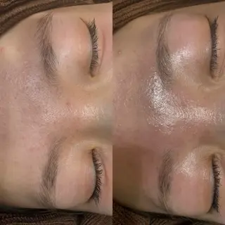 アイブロウ villa ☺︎草山 楓花のエステ・リラクイメージ