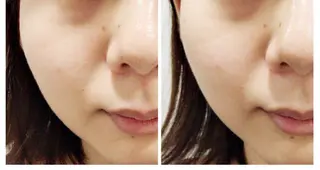 武蔵浦和　小顔矯正 リーフ　　武蔵浦和店のエステ・リラクイメージ