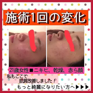 ミディアム カラー パーマ ヘアアレンジ メンズ キッズ ネイル マツエク・マツパ ニキビ・肌質改善専門 ♡人生が変わるサロンのエステ・リラクイメージ