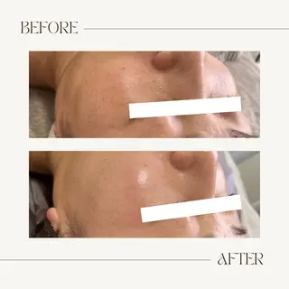 1st｜フェイシャル エステ専門店のエステ・リラクイメージ