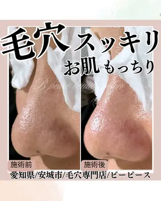 B  peace beauty salon所属・B peace. はるかのマツエク・マツパデザイン