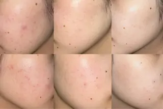 Belleつくば店所属・鈴木 華咲のエステ・リラクイメージ