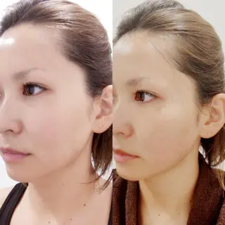 毒素出し専門サロンSylph(なかがわ整骨院併設サロン)所属・Mami Hataのエステ・リラクイメージ