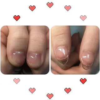 ショート ネイル フィルイン、長さ出し 深爪矯正のネイルデザイン