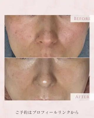 肌育フェイシャル🌿 noel🌿SAKIのエステ・リラクイメージ