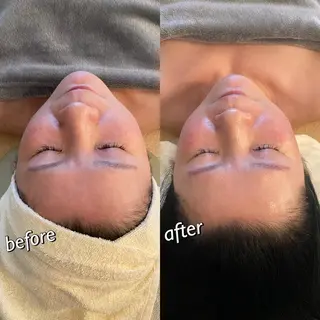 うなじ脱毛/美肌脱毛 LABELのエステ・リラクイメージ