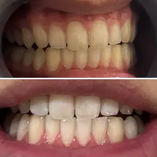 メンズ エマニエル USAのエステ・リラクイメージ