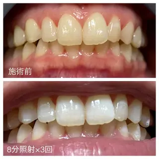 ネイル ネイル/耳つぼ /新ホワイトニングのネイルデザイン