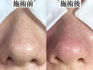 マツヤニワックス専門 堂山町 ルミエールのエステ・リラクイメージ