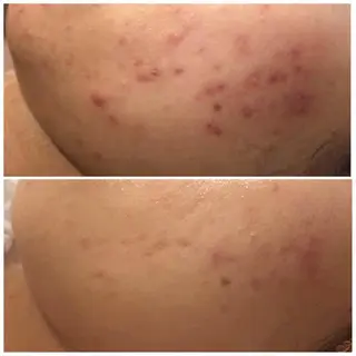 セミロング カラー パーマ ヘアアレンジ メンズ キッズ ネイル マツエク・マツパ アイブロウ ニキビ特化型エステ 🍓最短で肌質改善のエステ・リラクイメージ