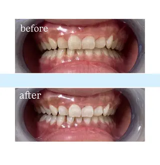 メンズ MiraeWhite所属・くるみ 🦷✨のその他イメージ