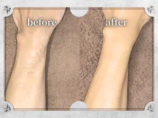 都度払い 脱毛 Lino柏/moeのエステ・リラクイメージ