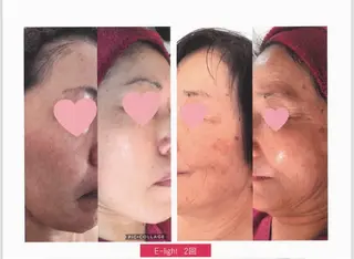 メンズ private salon meのエステ・リラクイメージ