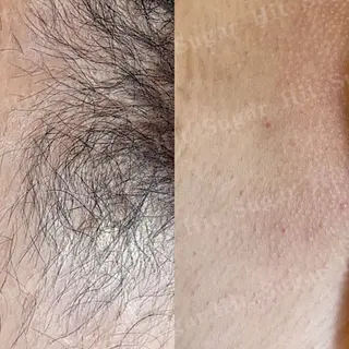 Hit. シュガーリング豊橋のエステ・リラクイメージ