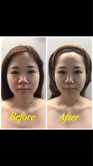 DeCoLé Beauty所属・艶肌/敏感肌/若さ/ ボディ痩身🌿のエステ・リラクイメージ