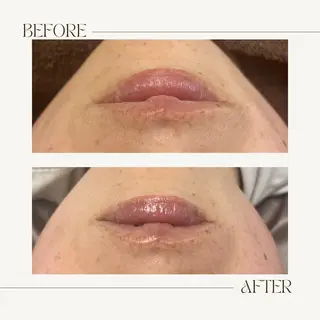 1st｜フェイシャル エステ専門店のエステ・リラクイメージ