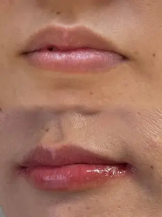 MINI町田所属・【ローマピンク施術】 Kaoのその他イメージ