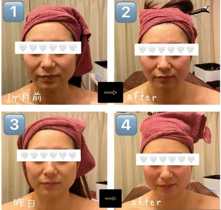 糸島 エステサロンmiuのエステ・リラクイメージ