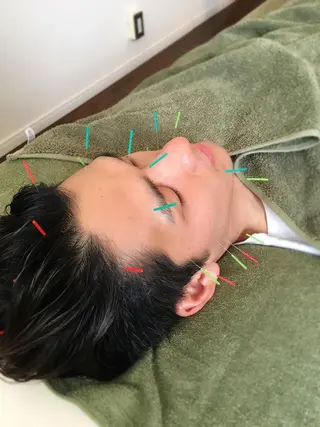 メンズ 【パーソナル鍼灸】 Pintのエステ・リラクイメージ