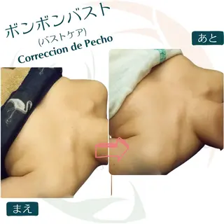 小顔矯正☀︎バスト ☀︎ハルのエステ・リラクイメージ