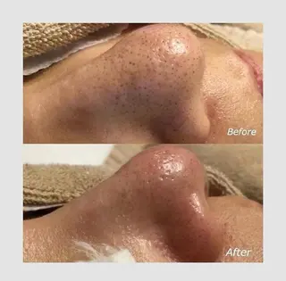 韓国肌管理 【毛穴専科】のエステ・リラクイメージ