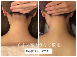 Beauty salon Lino所属・🎀うなじ脱毛🎀 ㅣLino堀江のエステ・リラクイメージ