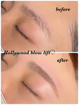 アイブロウ ハーブピーリング/韓国肌管理/フェイシャル/毛穴洗浄/眉毛/顔脱毛【糸脱毛専門】rev所属・ハーブピーリング🌹 毛穴洗浄❤️眉waxのエステ・リラクイメージ