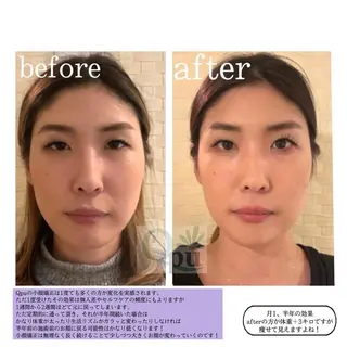 Qpu(キュープ)下北沢店所属・鮎川 さゆりのエステ・リラクイメージ