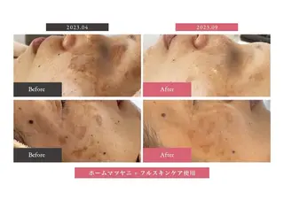 nouvelle  plume所属・ヌーベル プリュムのエステ・リラクイメージ