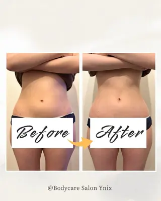 Bodycare salon Ynixのその他イメージ