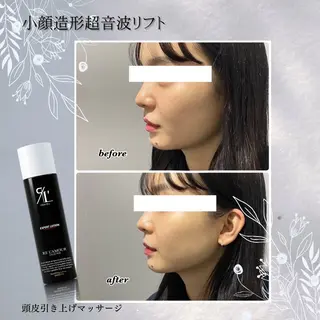 ENCHANT Kaede/肌質改善のその他イメージ