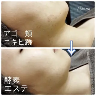 若返り 美肌   エステサロンららんのエステ・リラクイメージ