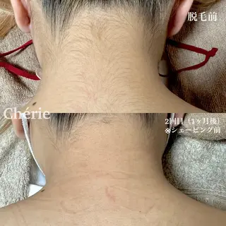 キッズ 大津 香（シェリー）のエステ・リラクイメージ