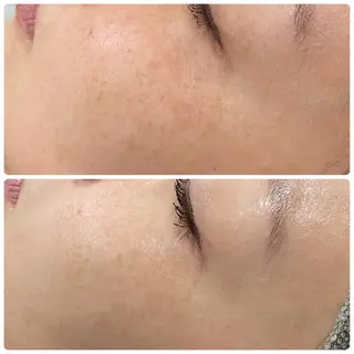 LiZA エステティックサロンのその他イメージ