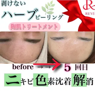 laluna saki...のその他イメージ