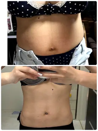 YOSA PARK Mahariのエステ・リラクイメージ