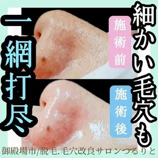 美肌脱毛サロン つるりと御殿場店所属・美肌脱毛サロン つるりとのその他イメージ