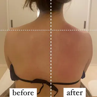 LibCharm🩰 村山美咲のエステ・リラクイメージ