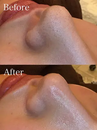 EARTH coiffure beaute 新潟紫竹山店所属・🤍アベシュリ /フェイシャル🤍のエステ・リラクイメージ