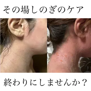 salon  OAK所属・痩身/肌改善/脱毛 /リラク/MoaNaのその他イメージ