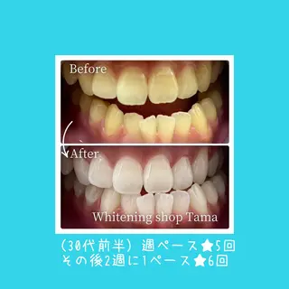 ホワイトニング ショップ多摩店のその他イメージ