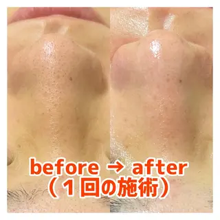 〜小顔・痩身・リラクゼーション〜　　Y&o Esthetic  Salon所属・HANA MIKIの眉毛・アイブロウイメージ