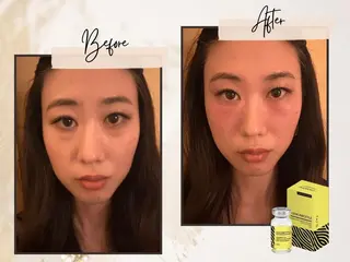 ララピール銀座 小顔フェイシャルのエステ・リラクイメージ