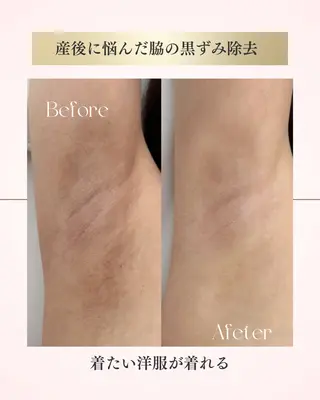 本気で痩せたい方へ 痩身専門サロンのエステ・リラクイメージ